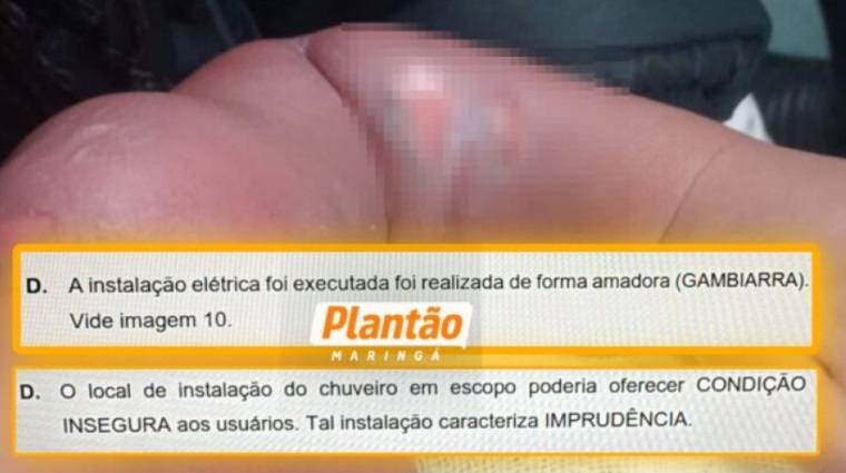 Laudo indica ligação elétrica irregular em chuveiro de CMEI onde bebê sofreu queimaduras em Sarandi